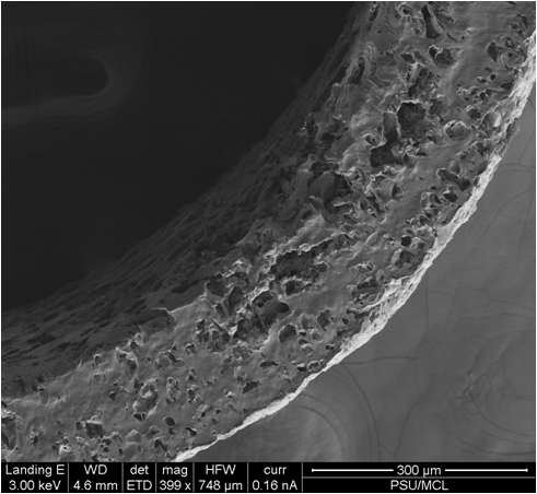 SEM image1